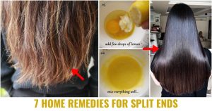 Read more about the article 7 Best Home Remedies For Split Ends